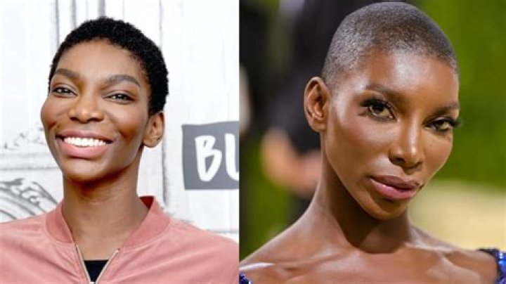 Michaela Coel Plastic Surgery